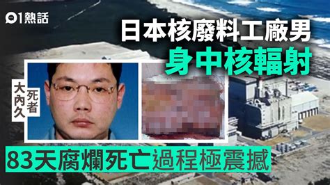 被輻射過的人|【被輻射過的人】你可能已慘遭輻射！9大恐怖症狀告訴你，你被。